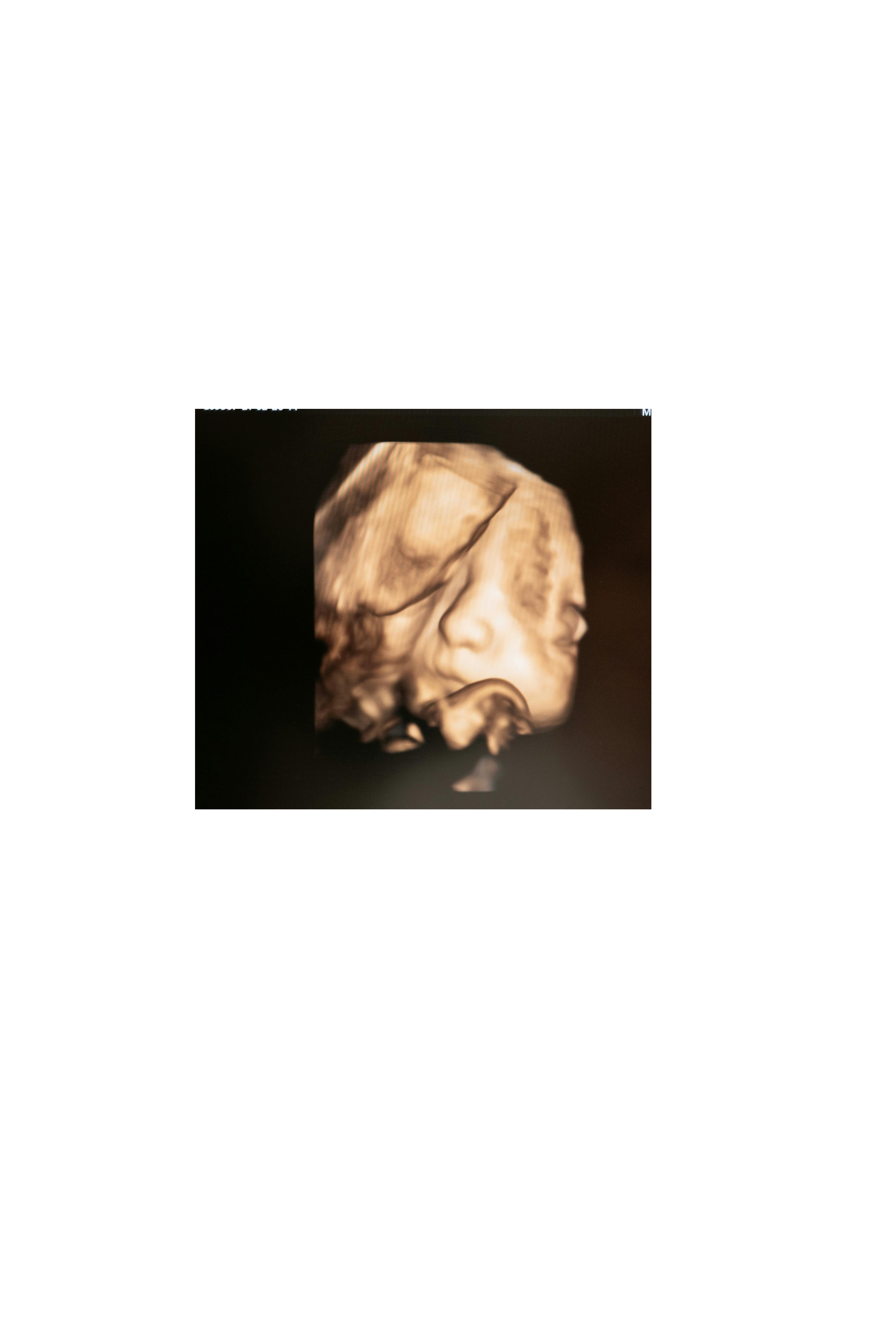 Example ultrasound image